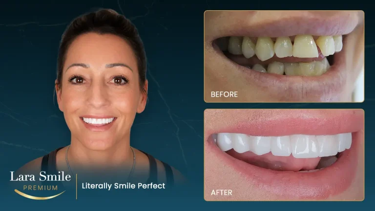 Lara Smile Premium - Antalya