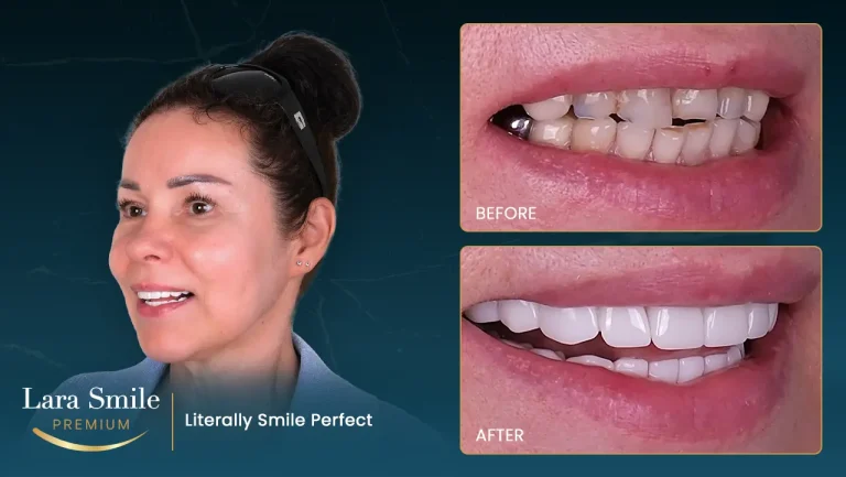 Lara Smile Premium - Antalya