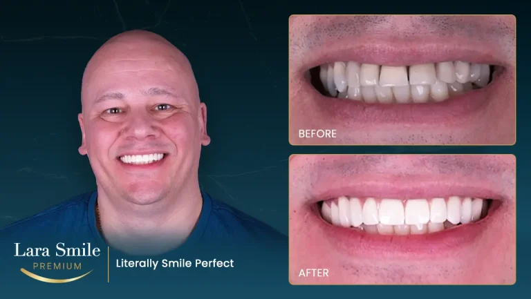 Lara Smile Premium - Antalya