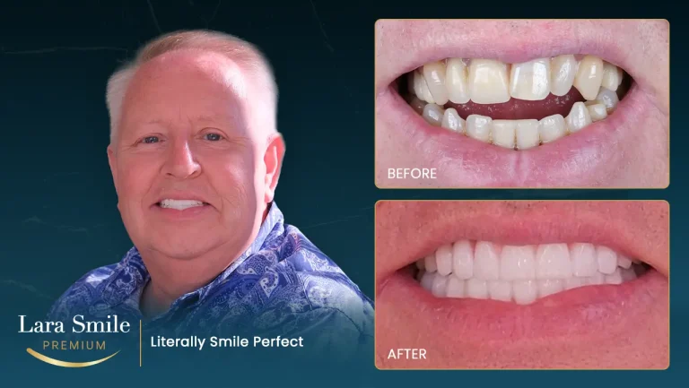 Lara Smile Premium - Antalya