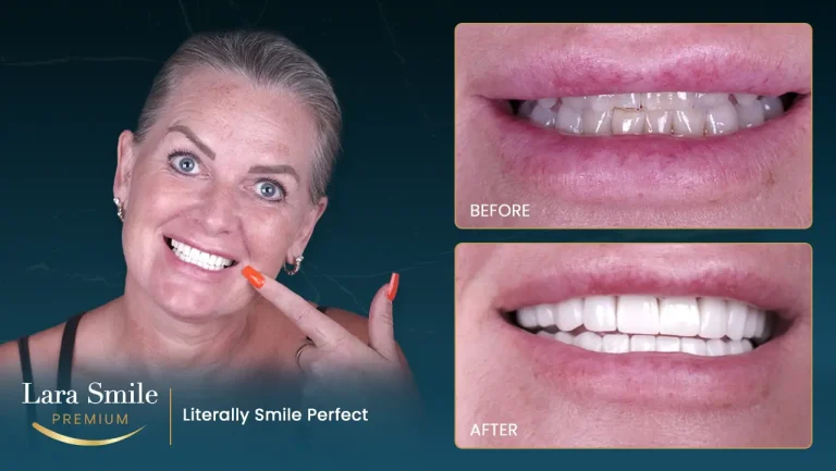 Lara Smile Premium - Antalya