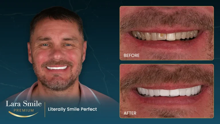 Lara Smile Premium - Antalya
