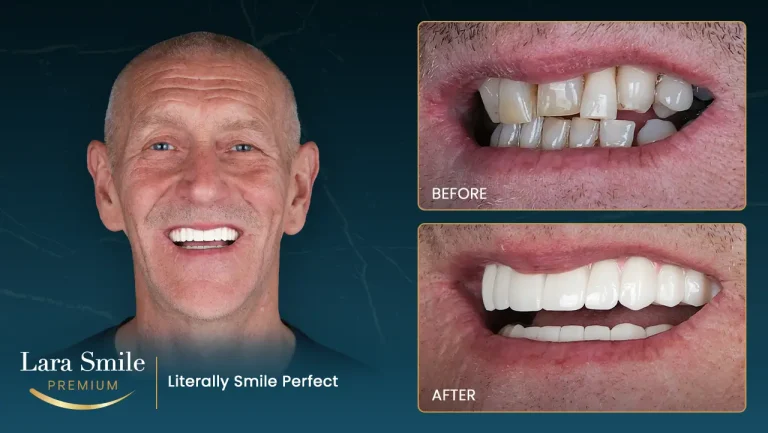 Lara Smile Premium - Antalya