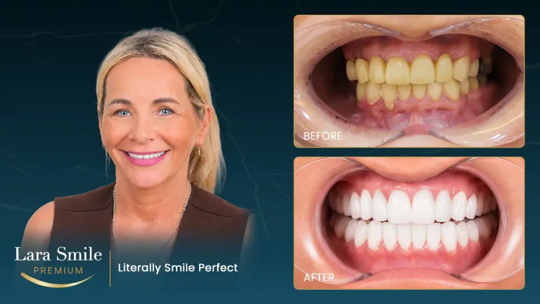 Lara Smile Premium - Antalya