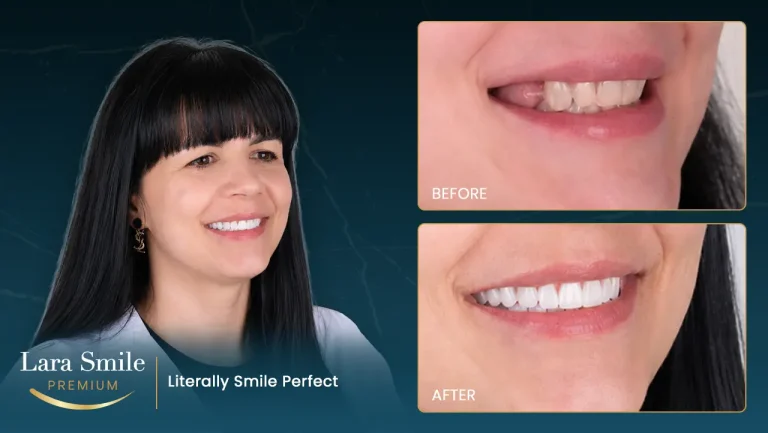 Lara Smile Premium - Antalya