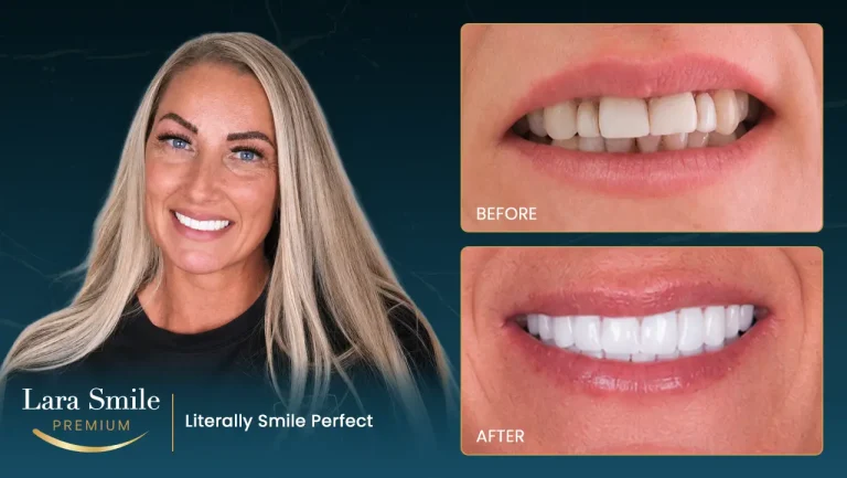 Lara Smile Premium - Antalya