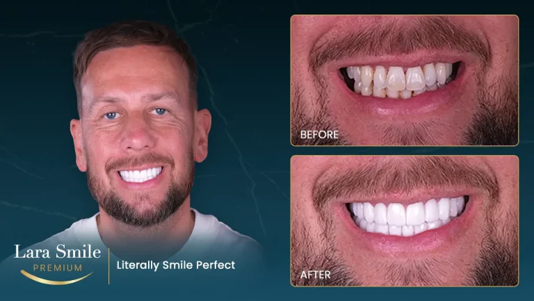 Lara Smile Premium - Antalya