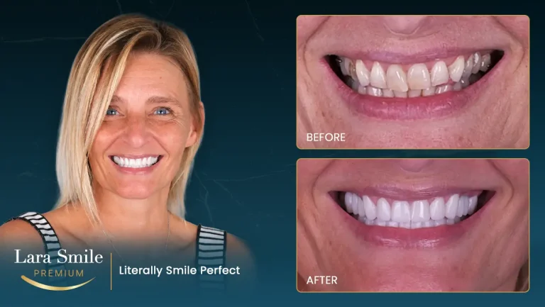 Lara Smile Premium - Antalya